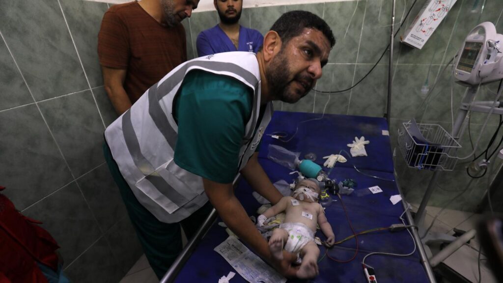 Gaza bambini I palestinesi feriti sono stati trasferiti all'ospedale Al-Najjar dopo essere stati presi di mira dagli aerei da guerra israeliani, nella città di Rafah, a sud della Striscia di Gaza, il 13 ottobre 2023.