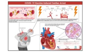 Arresto cardiaco indotto dal vaccino COVID-19