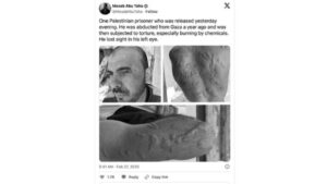 Ostaggio palestinese è stato rilasciato da da Israele dopo oltre un anno con orribili cicatrici su tutto il corpo - Febbraio 2025